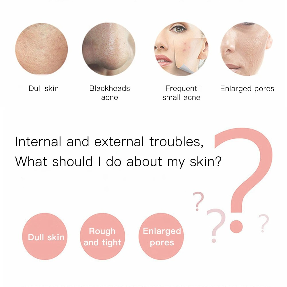 Épurateur ultrasonique de peau du visage, nettoyeur ionique