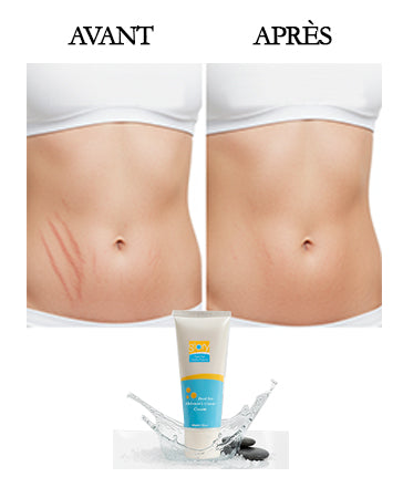 Crème anti-crevasses- femmes enceintes et sportif -80 ml GLORY
